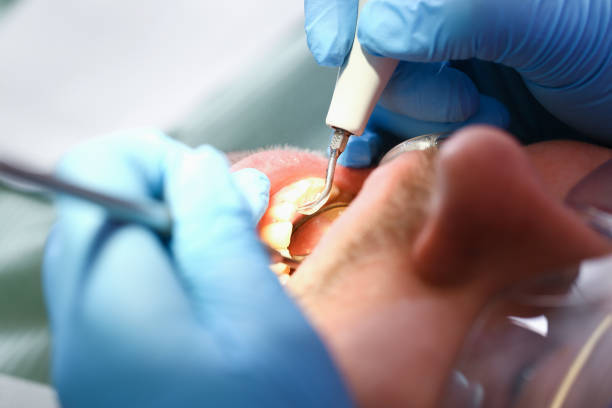 Best Chipped Tooth Repair Near Me  in East Sandwich, MA